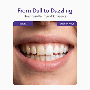 SOFTBRITE Gentle Whitening Strips (42 Strips)