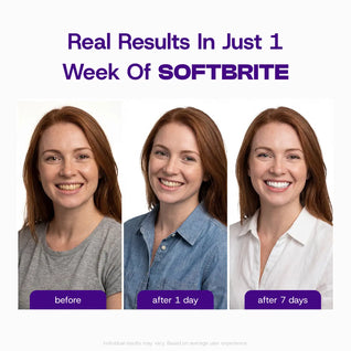 SOFTBRITE Gentle Whitening Strips (42 Strips)